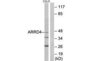 Western blot analysis of extracts from COLO cells, using ARRD4 Antibody. (ARRD4 antibody  (AA 127-176))