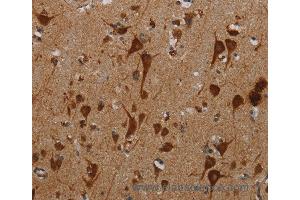 Immunohistochemistry of Human brain using KMT2D Polyclonal Antibody at dilution of 1:40