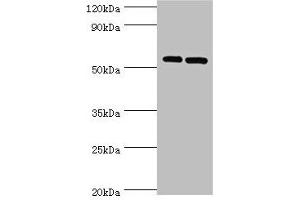 Western blot All lanes: PNPLA2 antibody at 10 μg/mL Lane 1: A431 whole cell lysate Lane 2: Hela whole cell lysate Secondary Goat polyclonal to rabbit IgG at 1/10000 dilution Predicted band size: 56, 20 kDa Observed band size: 56 kDa (PNPLA2 antibody  (AA 265-504))