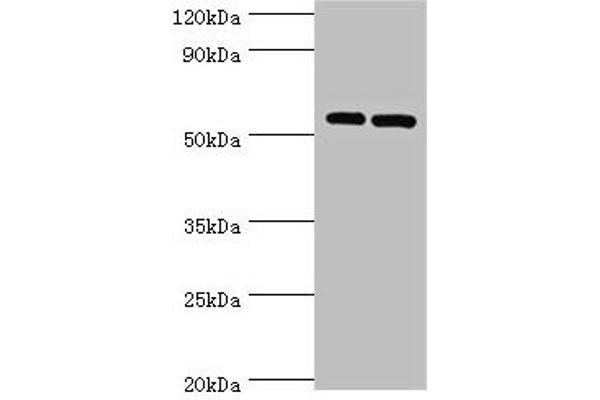 PNPLA2 Antikörper  (AA 265-504)