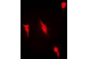 Immunofluorescent analysis of PRMT2 staining in Hela cells. (PRMT2 antibody)