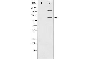 Western blot analysis of IGF1R expression in Insulin treated 293 whole cell lysates,The lane on the left is treated with the antigen-specific peptide. (IGF1R antibody  (C-Term))