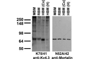 anti-Potassium Voltage-Gated Channel, Shal-Related Subfamily, Member 3 (KCND3) (AA 415-636), (C-Term), (Cytosolic) antibody