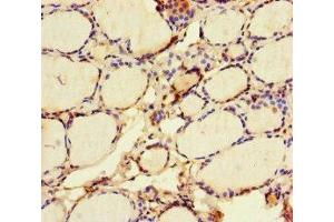 Immunohistochemistry of paraffin-embedded human thyroid tissue using ABIN7172419 at dilution of 1:100 (VGLL4 antibody  (AA 43-277))
