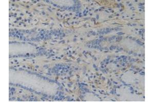 IHC-P analysis of Human Stomach Tissue, with DAB staining. (WARS antibody  (AA 247-458))