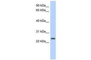 Image no. 1 for anti-Coiled-Coil Domain Containing 70 (CCDC70) (AA 71-120) antibody (ABIN6741256) (CCDC70 antibody  (AA 71-120))