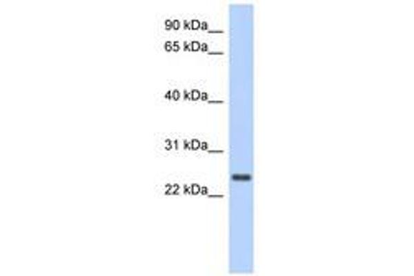 CCDC70 antibody  (AA 71-120)