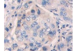 Immunohistochemistry (IHC) image for anti-Phosphoinositide-3-Kinase, Catalytic, beta Polypeptide (PIK3CB) (AA 321-507) antibody (ABIN7438307)