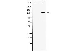 Western blot analysis of ATPase expression in PMA treated 293 whole cell lysates,The lane on the left is treated with the antigen-specific peptide. (ATP1A1 antibody  (N-Term))