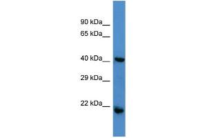 Host:  Rabbit  Target Name:  RGS7  Sample Type:  Jurkat Whole cell lysates  Antibody Dilution:  1. (RGS7 antibody  (N-Term))