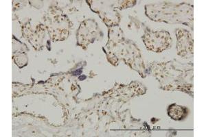 Image no. 1 for anti-Ets Variant 6 (ETV6) (AA 1-453) antibody (ABIN598674) (ETV6 antibody  (AA 1-453))