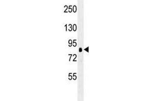 Western Blotting (WB) image for anti-Ribosomal Protein S6 Kinase, 90kDa, Polypeptide 1 (RPS6KA1) antibody (ABIN3032487)