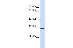 WB Suggested Anti-FGF14 Antibody Titration: 0. (FGF14 antibody  (Middle Region))
