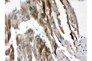 Anti-VDAC Picoband antibody, IHC(P) IHC(P): Mouse Cardiac Muscle Tissue (VDAC1 antibody  (Middle Region))