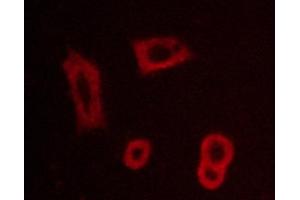 ABIN6267260 staining BT-20 cells by ICC/IF. (EGFR antibody  (pTyr1016))