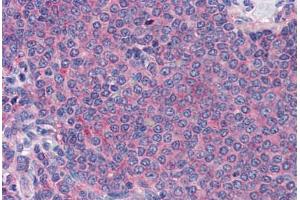 Human Spleen (formalin-fixed, paraffin-embedded) stained with LY75 antibody ABIN337388 at 10 ug/ml followed by biotinylated goat anti-rabbit IgG secondary antibody ABIN481713, alkaline phosphatase-streptavidin and chromogen. (LY75/DEC-205 antibody  (C-Term))