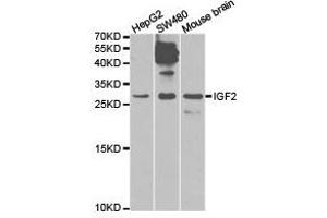 Western Blotting (WB) image for anti-Insulin-Like Growth Factor 2 (IGF2) antibody (ABIN1873163) (IGF2 antibody)