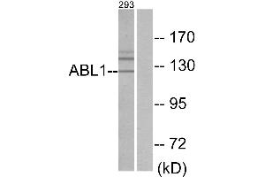 Immunohistochemistry analysis of paraffin-embedded human brain tissue using ABL1 antibody. (ABL1 antibody  (Internal Region))