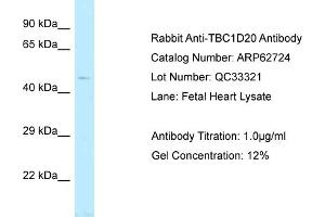 Western Blotting (WB) image for anti-TBC1 Domain Family, Member 20 (TBC1D20) (C-Term) antibody (ABIN2789226) (TBC1D20 antibody  (C-Term))