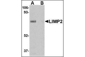 Western blot analysis of LIMP2 in human skeletal muscle tissue lysate with this product at 1 μg/ml in (A) the absence and (B) presence of blocking peptide. (SCARB2 antibody  (Center))