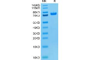PAD4 Protein (AA 1-663) (His tag,Biotin)