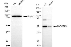 Western blotting analysis using MAPKAPK5 antibody (ABIN7799477). (MAPKAP Kinase 5 antibody)