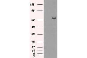 HEK293T cells were transfected with the pCMV6-ENTRY control (Left lane) or pCMV6-ENTRY HDAC10 (Right lane) cDNA for 48 hrs and lysed. (HDAC10 antibody)