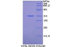 SDS-PAGE analysis of Mouse Vang Like Protein 1 Protein. (Vangl1 Protein)