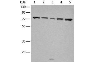 Western blot analysis of Hela and A431 cell Mouse brain tissue HT-29 and Jurkat cell lysates using GARS Polyclonal Antibody at dilution of 1:540 (GARS antibody)