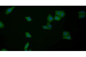 Detection of GAL3 in Human MCF7 cell using Polyclonal Antibody to Galectin 3 (GAL3) (Galectin 3 antibody  (AA 1-250))