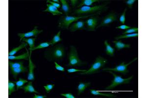 Immunofluorescence of purified MaxPab antibody to STX11 on HeLa cell.