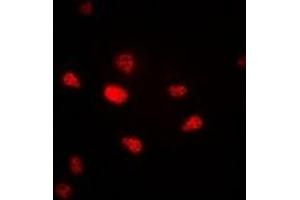 Immunofluorescent analysis of Progesterone Receptor staining in A549 cells. (Progesterone Receptor antibody)