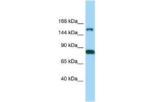 Host: Rabbit Target Name: IQSEC2 Sample Type: MDA-MB-435S Whole Cell lysates Antibody Dilution: 1. (IQSEC2 antibody  (Middle Region))