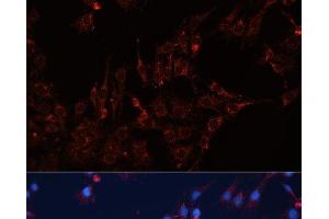 Immunofluorescence analysis of C6 cells using GNAI2 Polyclonal Antibody at dilution of 1:100 (40x lens). (GNAI2 antibody)
