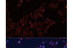 Immunofluorescence analysis of C6 cells using GNAI2 Polyclonal Antibody at dilution of 1:100 (40x lens).