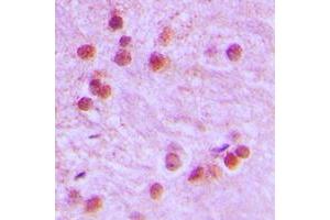 Immunohistochemical analysis of FOXR1 staining in human brain formalin fixed paraffin embedded tissue section. (FOXR1 antibody  (C-Term))