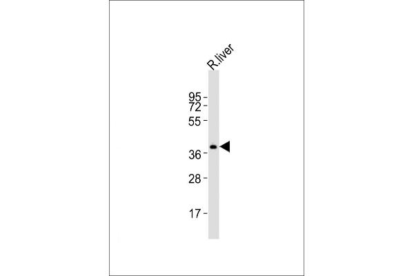 TREX2 antibody  (C-Term)