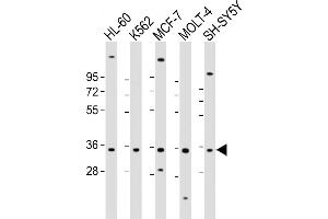 All lanes : Anti-PIGC Antibody (Center) at 1:2000 dilution Lane 1: HL-60 whole cell lysate Lane 2: K562 whole cell lysate Lane 3: MCF-7 whole cell lysate Lane 4: MOLT-4 whole cell lysate Lane 5: SH-SY5Y whole cell lysate Lysates/proteins at 20 μg per lane. (PIGC antibody  (AA 81-112))