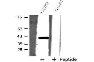 Western blot analysis of extracts from COLO205 cells, using ORCTL-2 antibody. (ORCTL-2/SLC22A18 antibody  (C-Term))