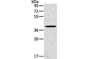 Western blot analysis of Lovo cell, using CAB39 Polyclonal Antibody at dilution of 1:200 (CAB39 antibody)