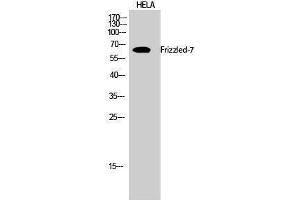 Western Blotting (WB) image for anti-Frizzled Family Receptor 7 (FZD7) (N-Term) antibody (ABIN3184691) (FZD7 antibody  (N-Term))