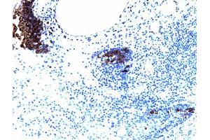 PDGFRbeta (pY857) staining on tonsil. (PDGFRB antibody  (pTyr857))