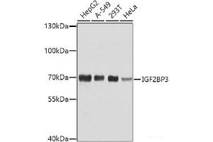 Western blot analysis of extracts of various cell lines using IGF2BP3 Polyclonal Antibody at dilution of 1:1000. (IGF2BP3 antibody)