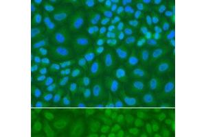 Immunofluorescence analysis of A549 cells using TDG Polyclonal Antibody (TDG antibody)