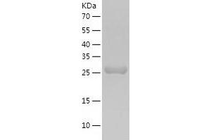 Western Blotting (WB) image for Methylmalonic Aciduria (Cobalamin Deficiency) CblC Type, with Homocystinuria (MMACHC) (AA 1-282) protein (His tag) (ABIN7123941)