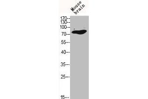 Western Blot analysis of MOUSE-BRAIN cells using C-TAK1 Polyclonal Antibody (MARK3 antibody  (N-Term))