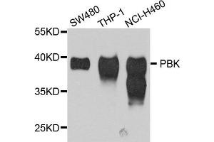 Western blot analysis of extracts of various cell lines, using PBK antibody (ABIN5995492) at 1/1000 dilution. (Symplekin antibody)