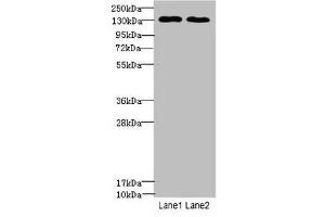 Western blot All lanes: TPP2antibody at 3. (Tpp2 antibody  (AA 1-300))