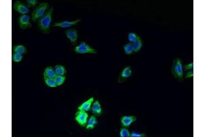 Immunofluorescent analysis of PC-3 cells using ABIN7173103 at dilution of 1:100 and Alexa Fluor 488-congugated AffiniPure Goat Anti-Rabbit IgG(H+L) (TMEM177 antibody  (AA 219-311))