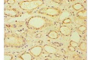 Immunohistochemistry of paraffin-embedded human kidney tissue using ABIN7158678 at dilution of 1:100 (BRCC3 antibody  (AA 1-316))